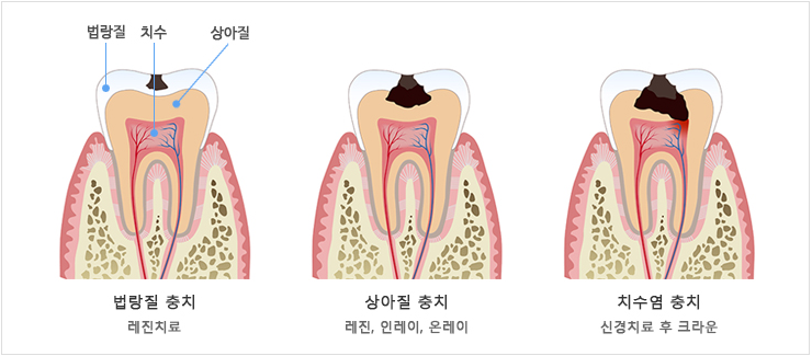 이미지명